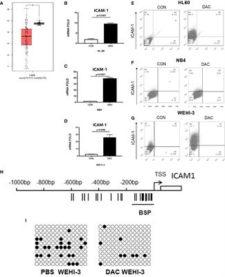 Acute Myeloid Leukemia Epigenetic Immune Escape From Nature Killer Cells by ICAM-1